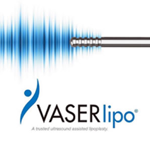 vaserlipo